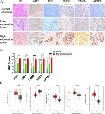 Roles and Clinical Significances of ATF6, EMC6, and APAF1 in Prognosis of Pancreatic Cancer